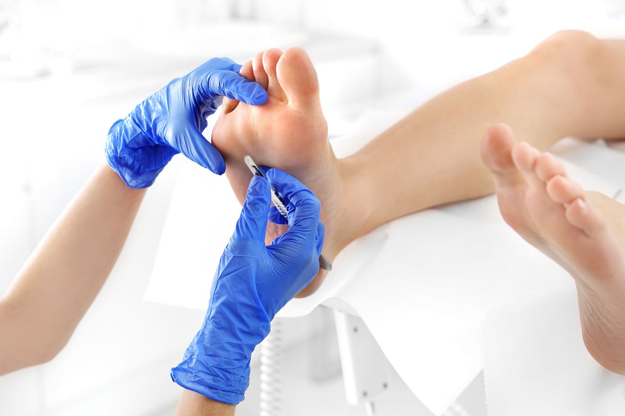 Schorzenia stopy – przebieg leczenia i środki, jakie należy stosować