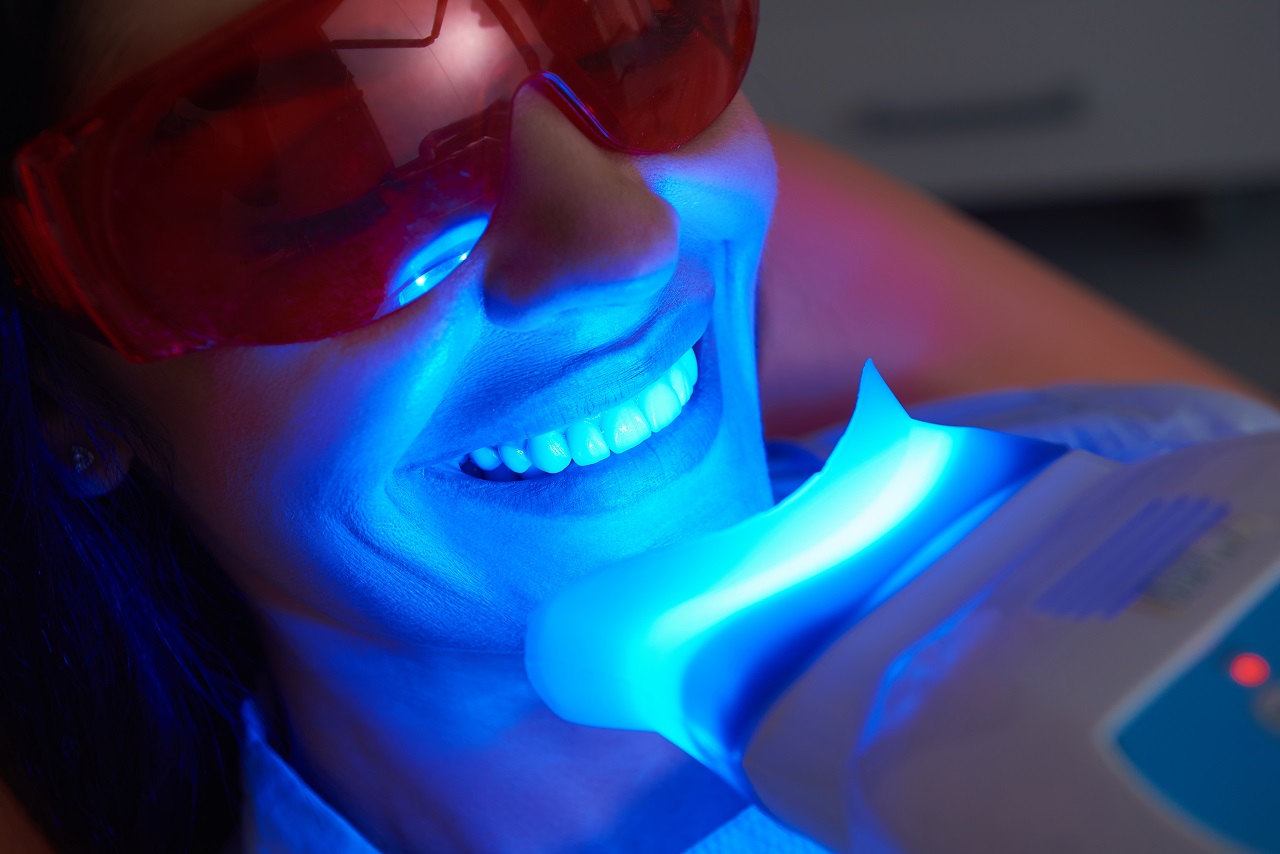 Metody wybielania zębów – jak to zrobić skutecznie?
